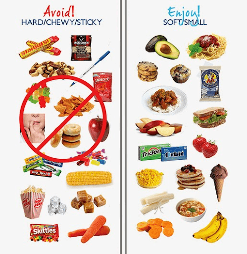 diagram list of foods to avoid for patients with braces and preferred foods that are ok for patients with braces